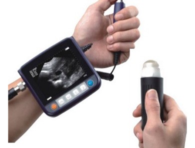 Meditech Miniscan Wrist Ultrasound Scanner for Small and Large Animals